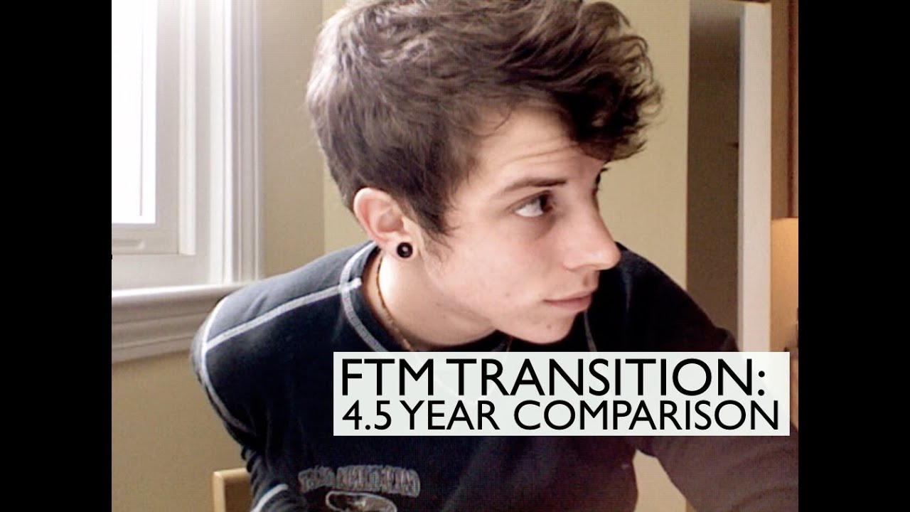 FTM Transition: 4.5 years on Testosterone comparison!