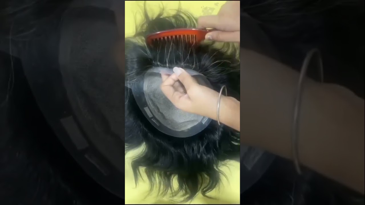 Australia Mirage Hair Patch #hairpatch #shortsfeed #shorts #short #viral
