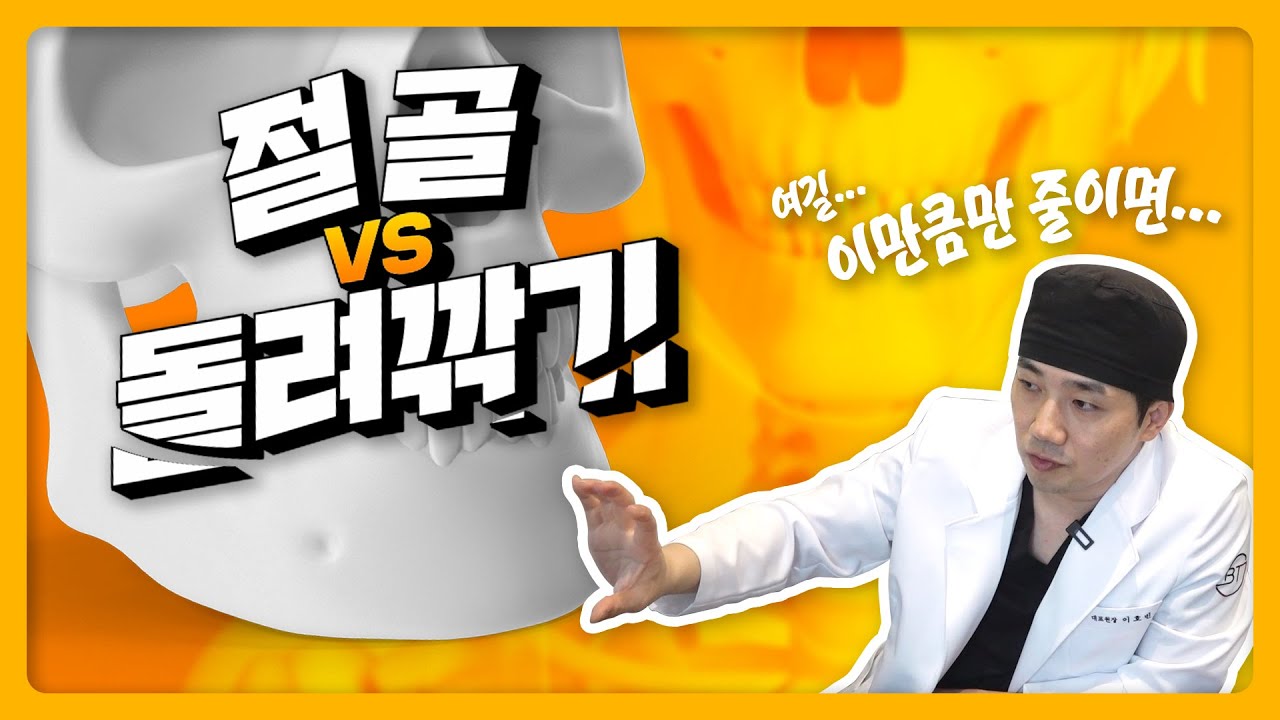 안면윤곽(턱끝)수술 절골 VS 돌려깎기 선택은?