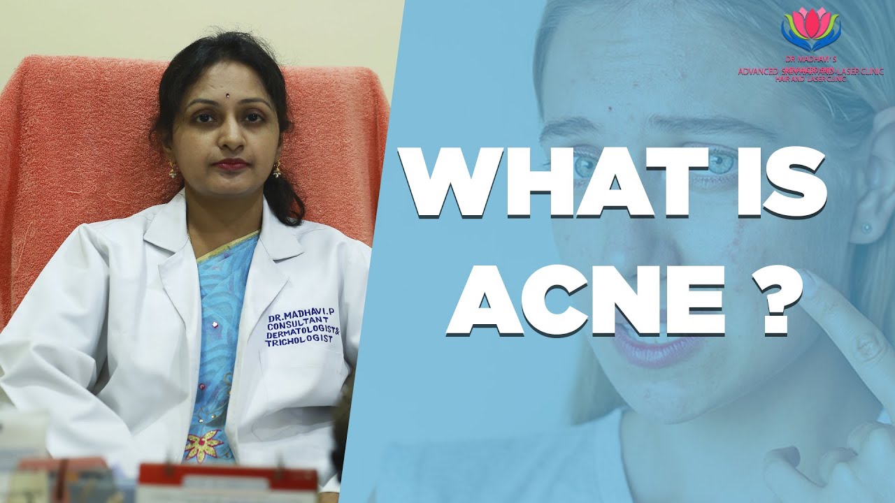 WHAT IS ACNE ? | Dr.Madhavi's Advanced Skin Hair and Laser Clinic