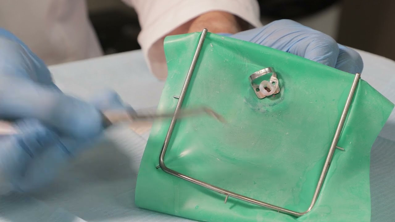 Técnica de secuencia clínica de pulpectomía