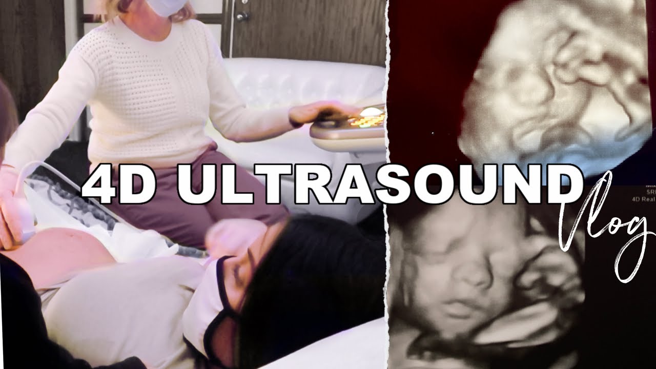 4D Ultrasound At 32 Weeks