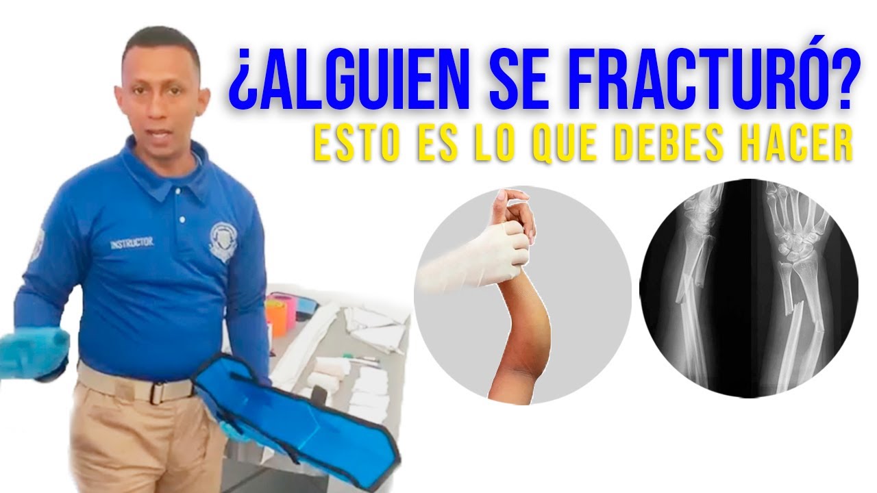 Cómo inmovilizar una fractura paso a paso – Primeros Auxilios