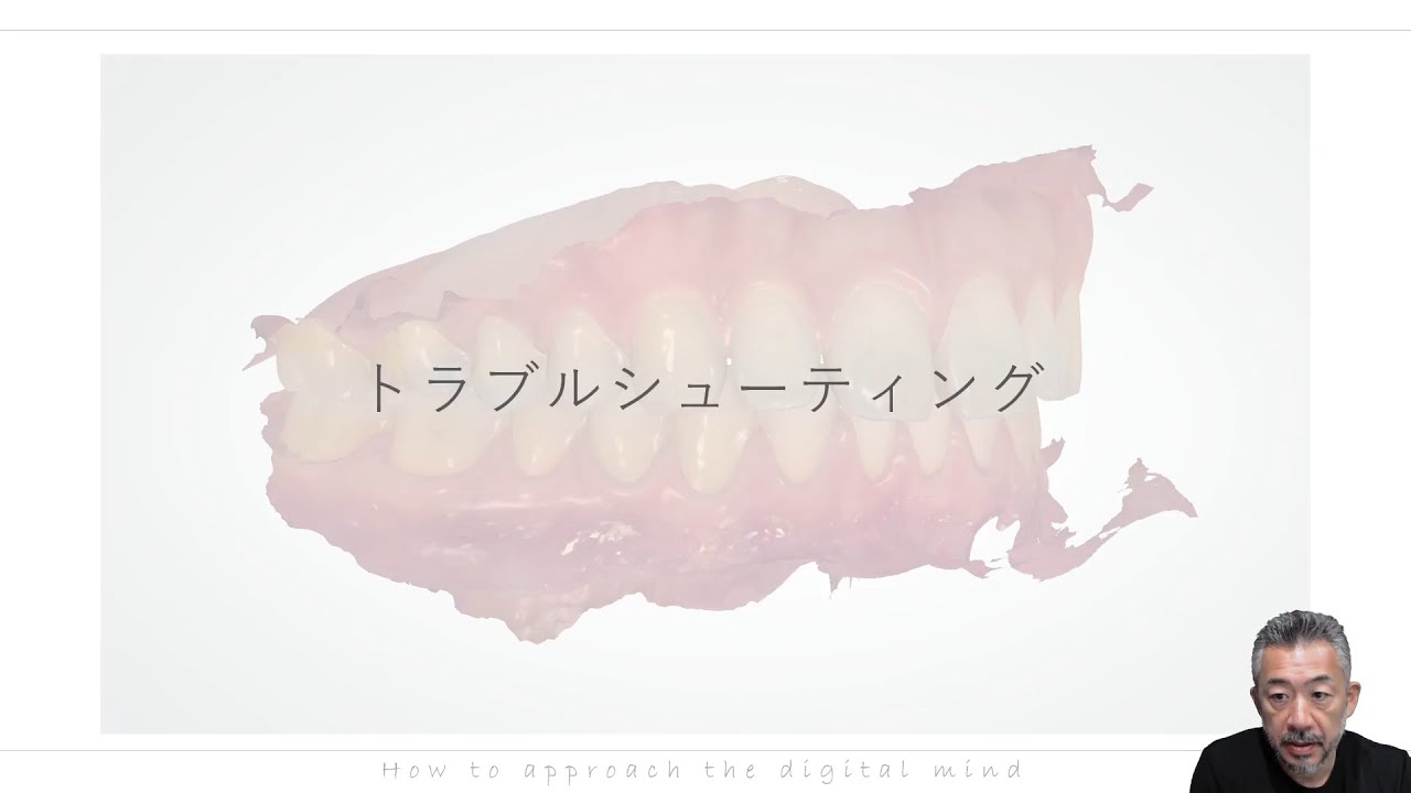 口腔内スキャナーのトラブルシューティング