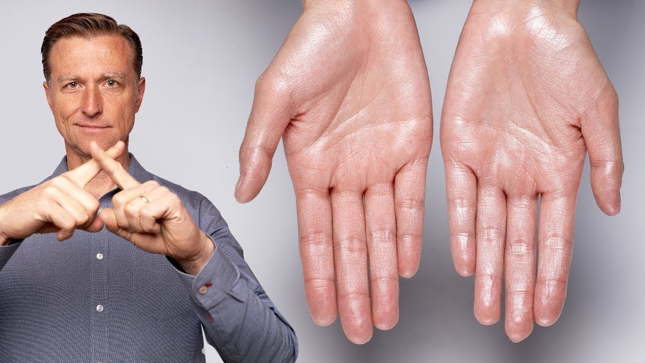 Aşırı Terleme Problemine Son | Dr.Berg T&uuml;rk&ccedil;e