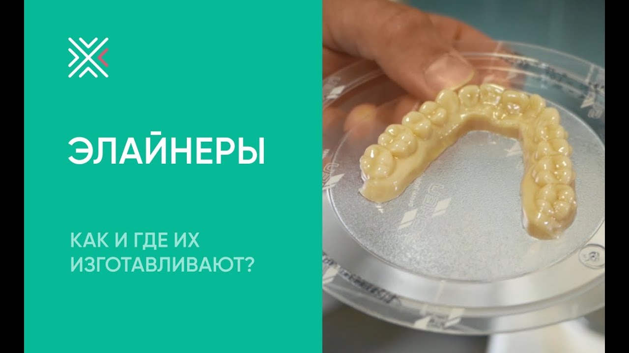 Элайнеры для выравнивания зубов: как и где их изготавливают?