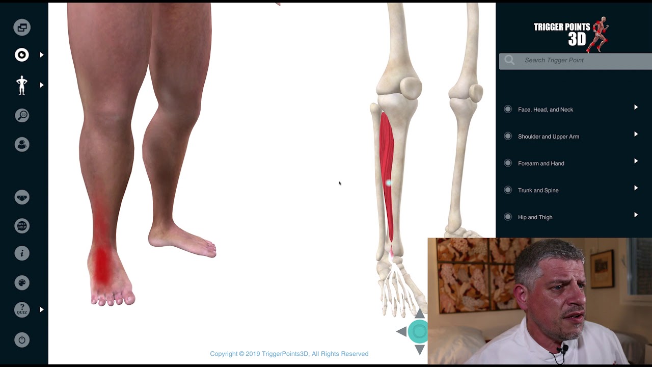Extensor Digitorum Longus and Brevis - Trigger Point of the Week