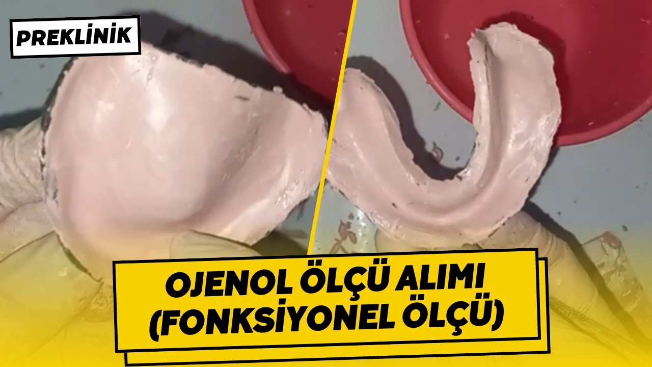 Ojenol Ölçü Alımı