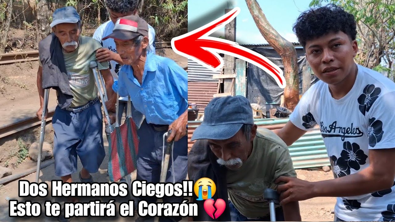 LOS PERSEGUIMOS ASTA SU CASA Y CON ESTO NOS SORPRENDIÓ| QUEDARON CIEGOS POR UN ACCID£NT£