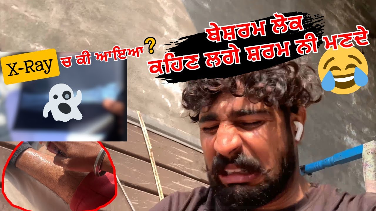 Ankle Pain da X-Ray… Report: Sab OK? Masti Full On 😂 Maan Bir