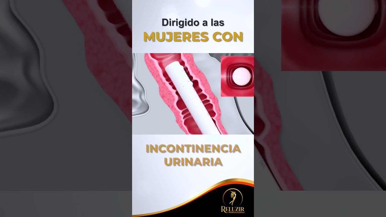 #shorts | HIFU INTIMO EN RELUZIR