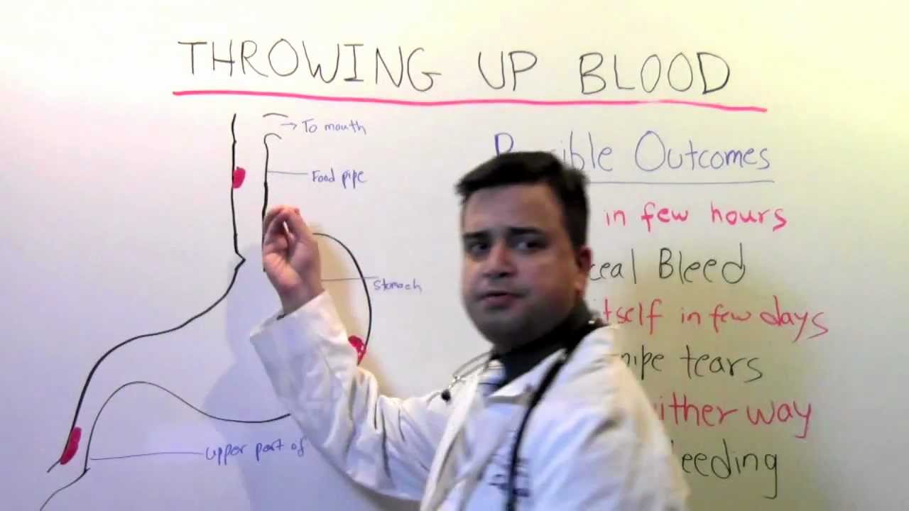 Throwing up blood: A video for patients