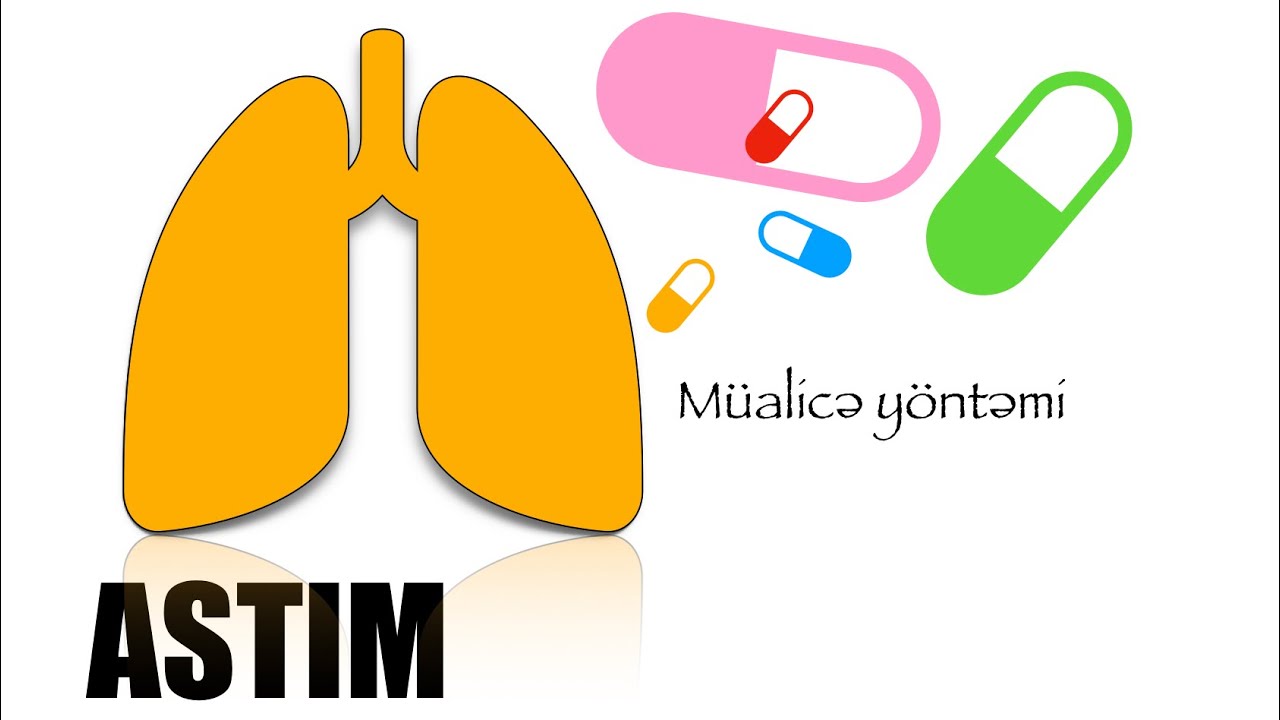 Astım basamak tedavisi (STEP tedavisi). #TUS #YDUS #USMLE | TUS sınav sorularına tam uyğun