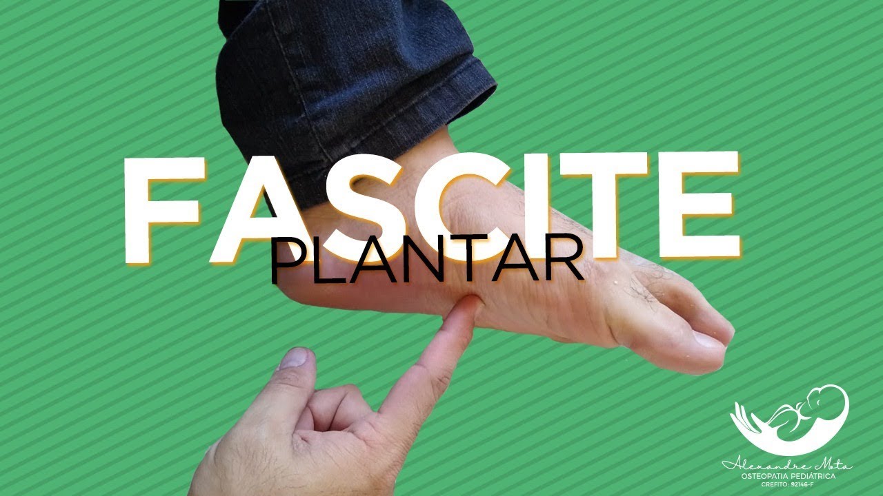 Fascite Plantar - Como Aliviar a Dor no Pé