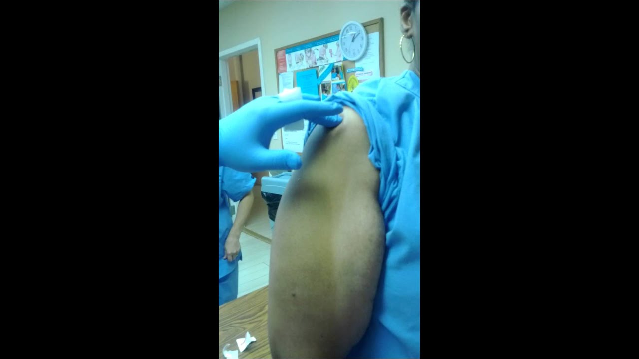 Intramuscular injection