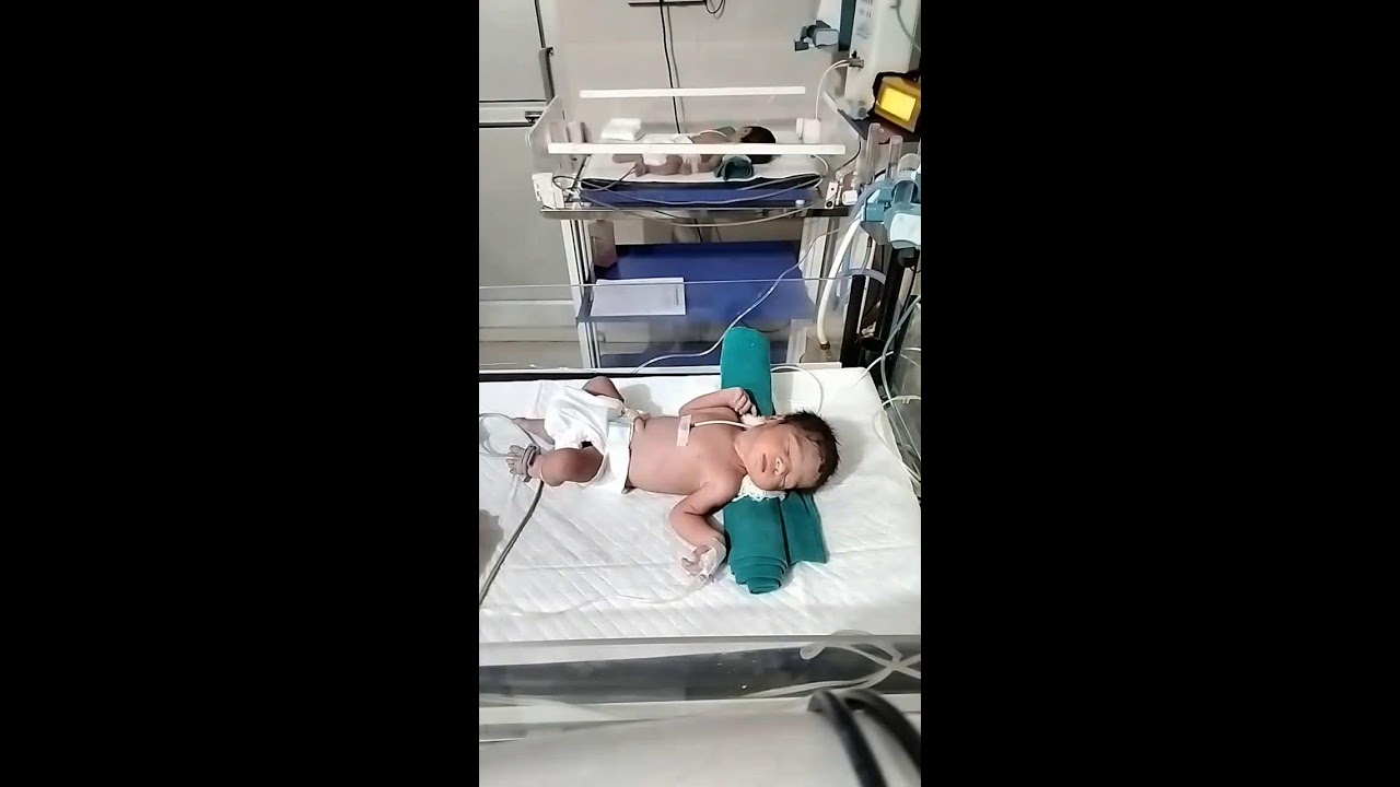 Icu and. Nicu care and treatment in NICU picu NICU
