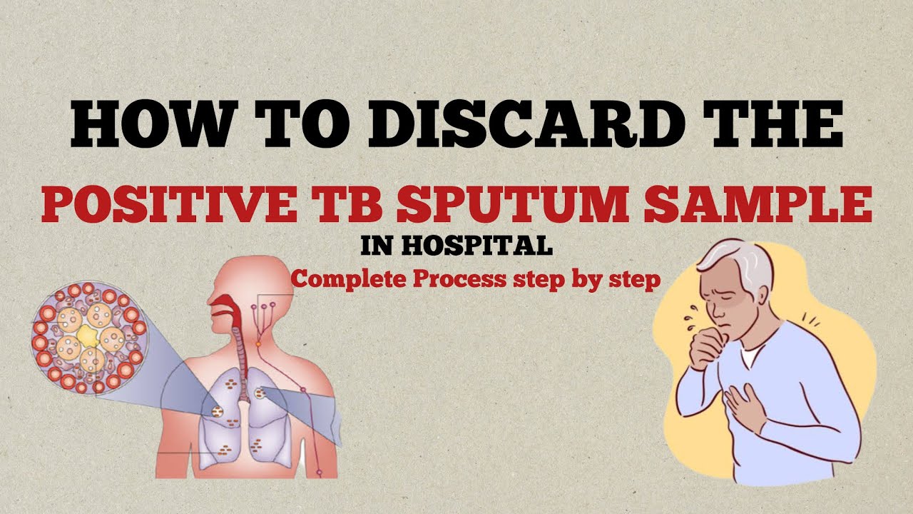 How to discard the positive TB sputum sample in Hospital | TB Positive Sputum Disposal Method 