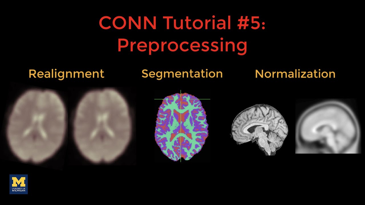 CONN Tutorial #5: Preprocessing