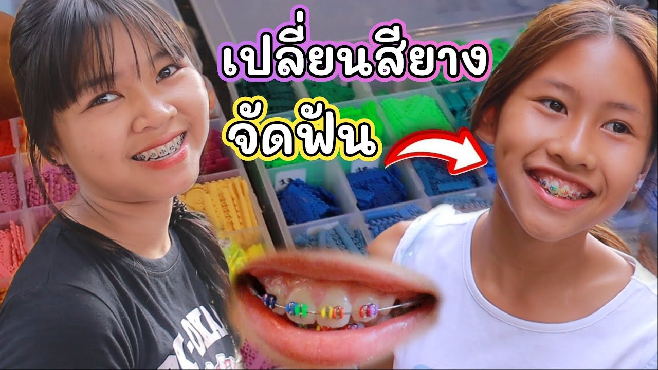 เกลลี่ ไปคลินิกจัดฟัน เปลี่ยนสียางเป็นสีสายรุ้ง สีนี้ชอบมากถูกใจสุดๆ คุณหมอจัดให้ 🥰