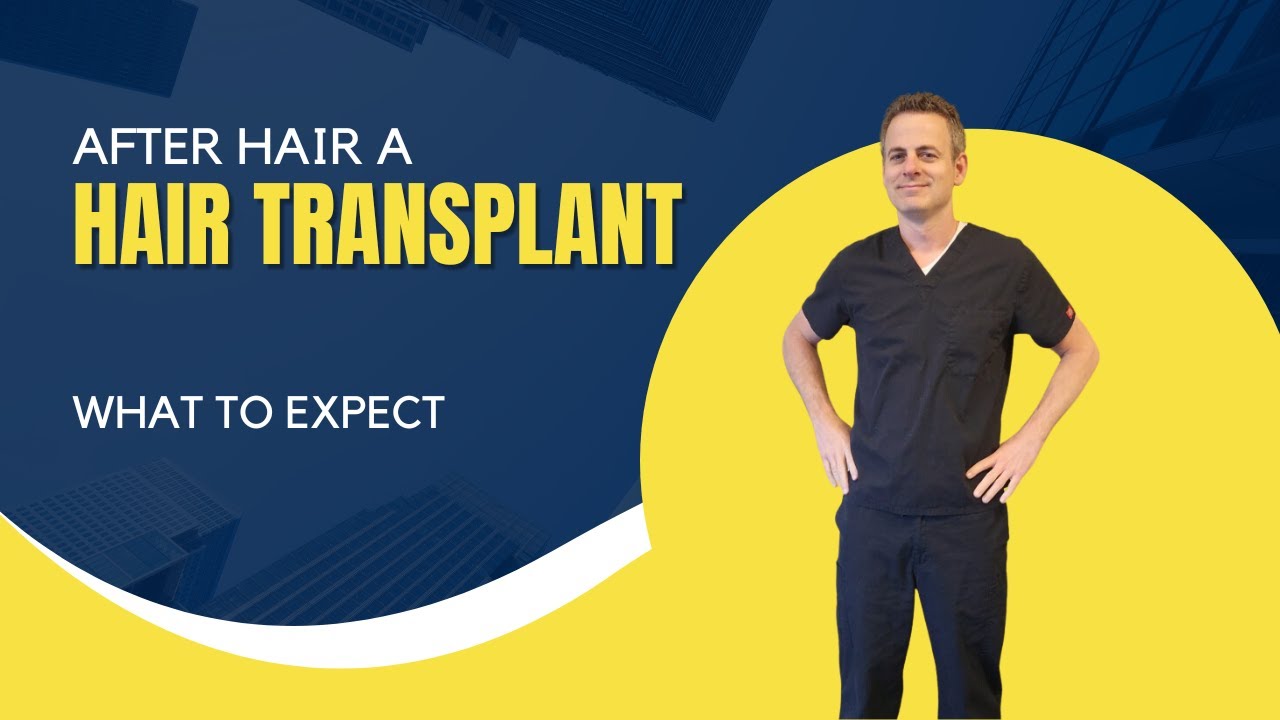 After Hair Transplantation:  When to expect the results.