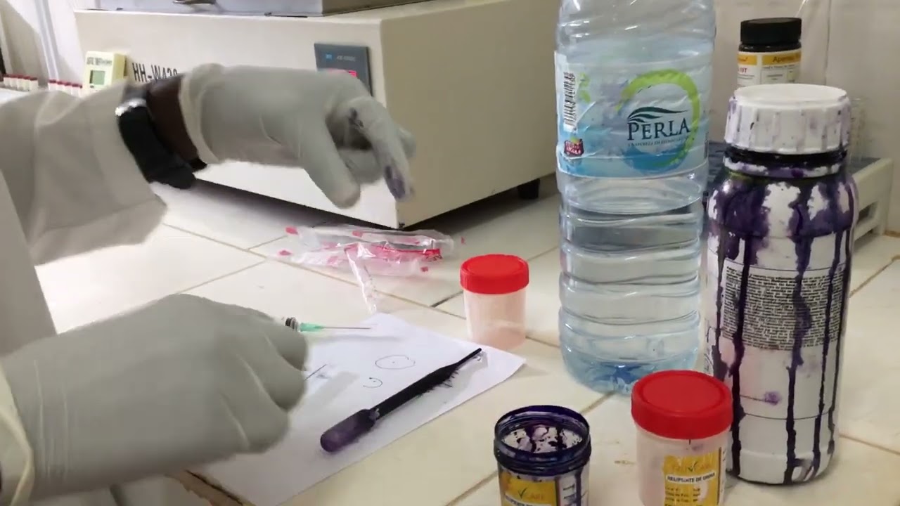 Técnica Laboratorial de preparação do GIEMSA
