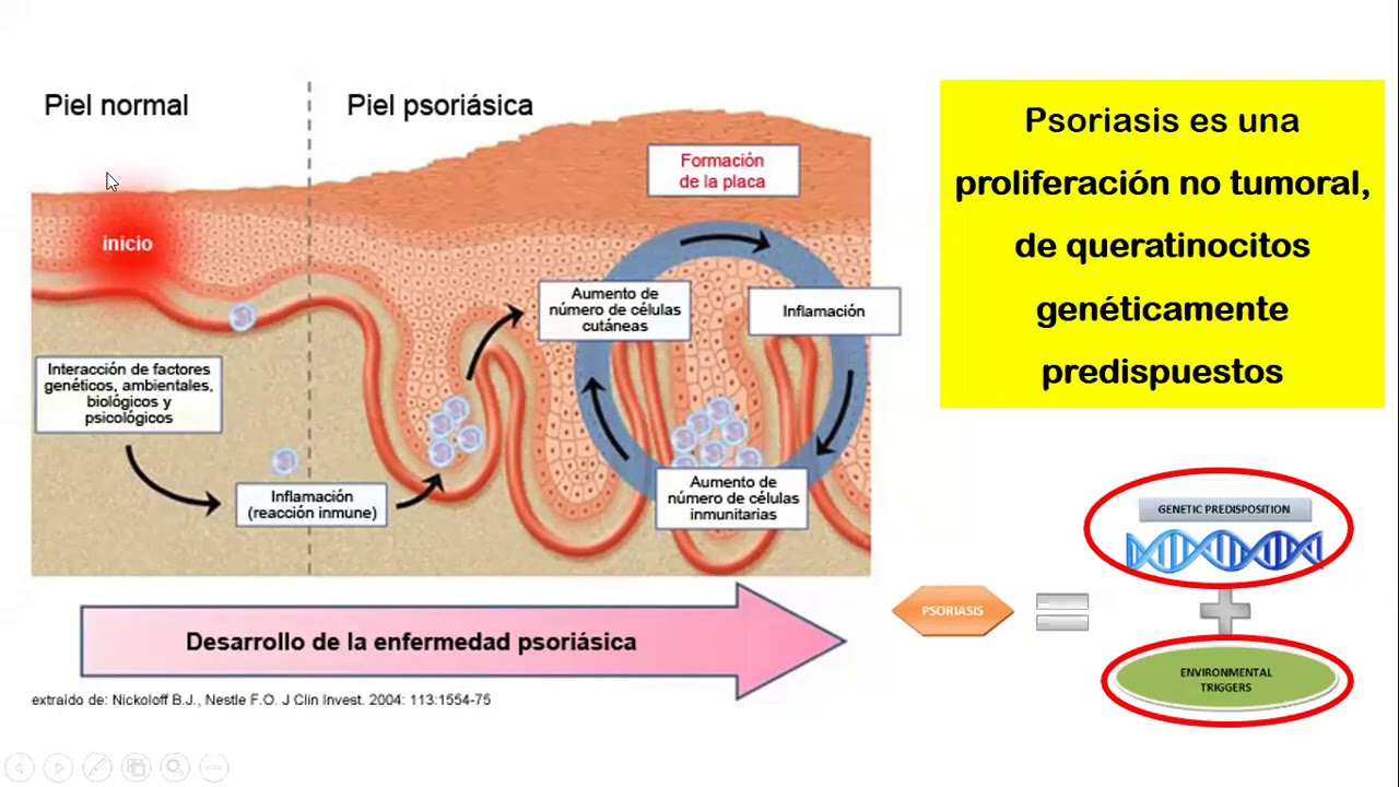 FISIOPATOLOGÍA - Semana 9 - Psoriasis y Dermatitis Atópica