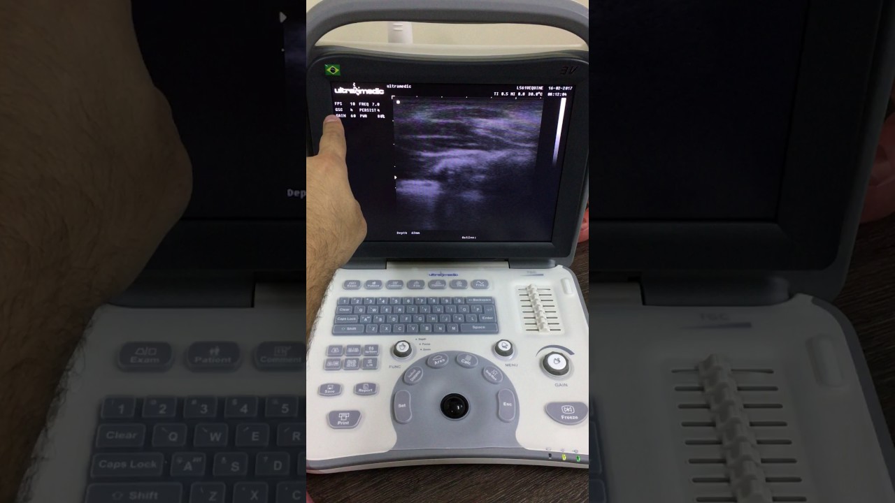 ultrassom veterinário infinit 3V - apresentação