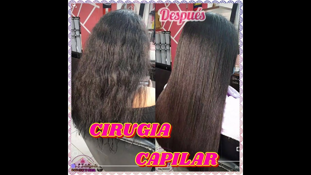 Como aplicar Cirugía capilar Fácil paso a paso
