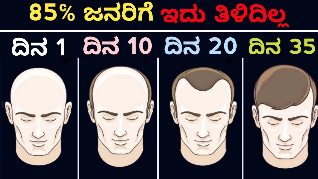 7 WAYS TO STOP HAIR FALL & NATURALLY REGROW HAIR - Time For Greatness Kannada