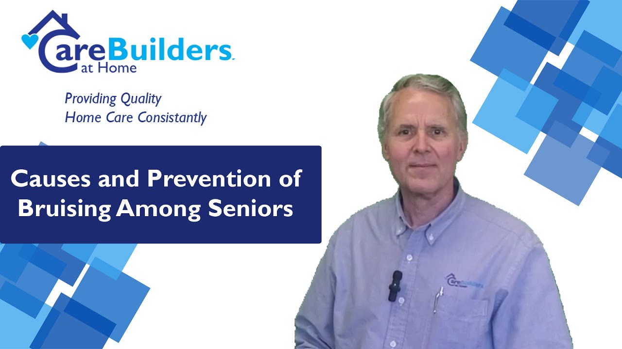 Causes and Prevention of Bruising Among Seniors