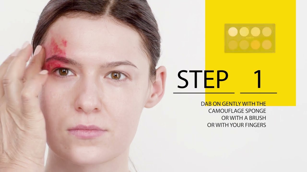How To Cover Port Wine Stains and Birthmarks With Skin Camouflage Makeup