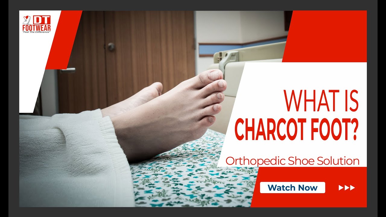 Charcot Foot Shoe Options
