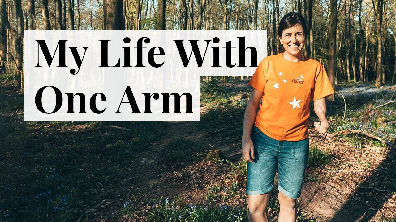 Living with One Arm | My Life with an Upper Limb Difference...