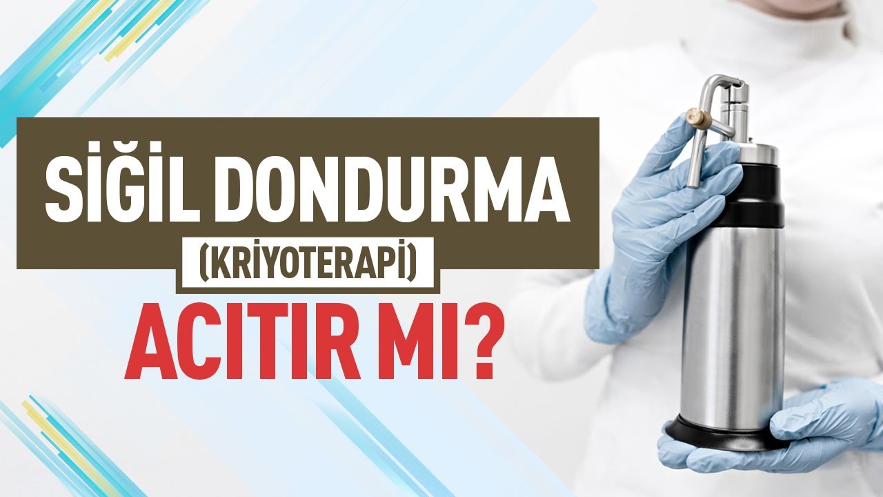 Siğil Dondurma (Kriyoterapi) Nedir? Siğil Dondurma İşlemi Zararlı Mı? Kriyoterapi Fiyatları