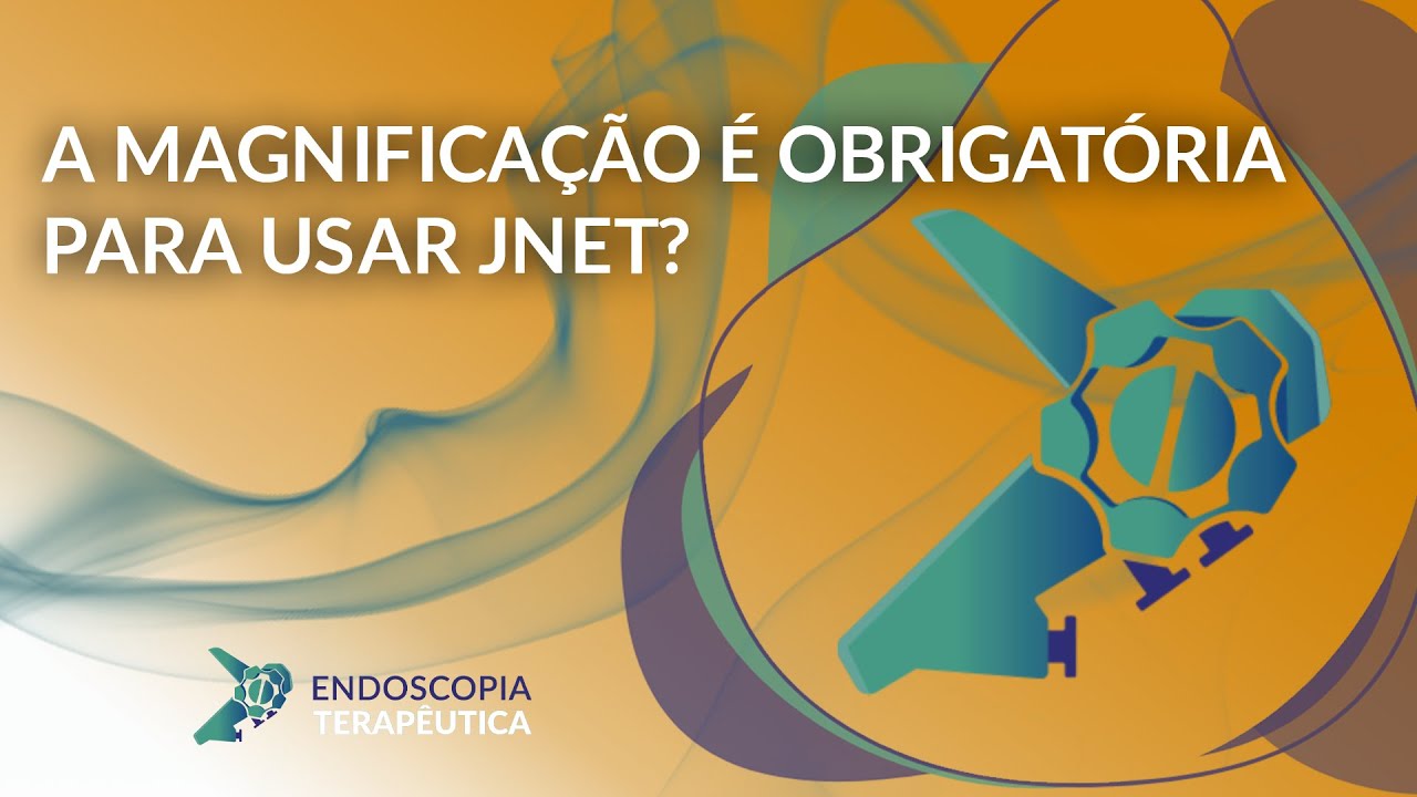 A magnificação é obrigatória para usar JNET?