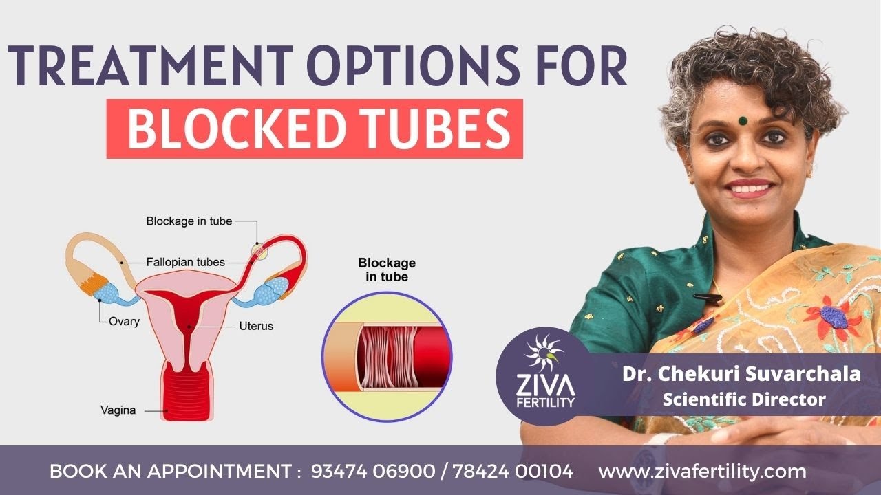 Treatment options for blocked fallopian tubes || Dr Chekuri Suvarchala