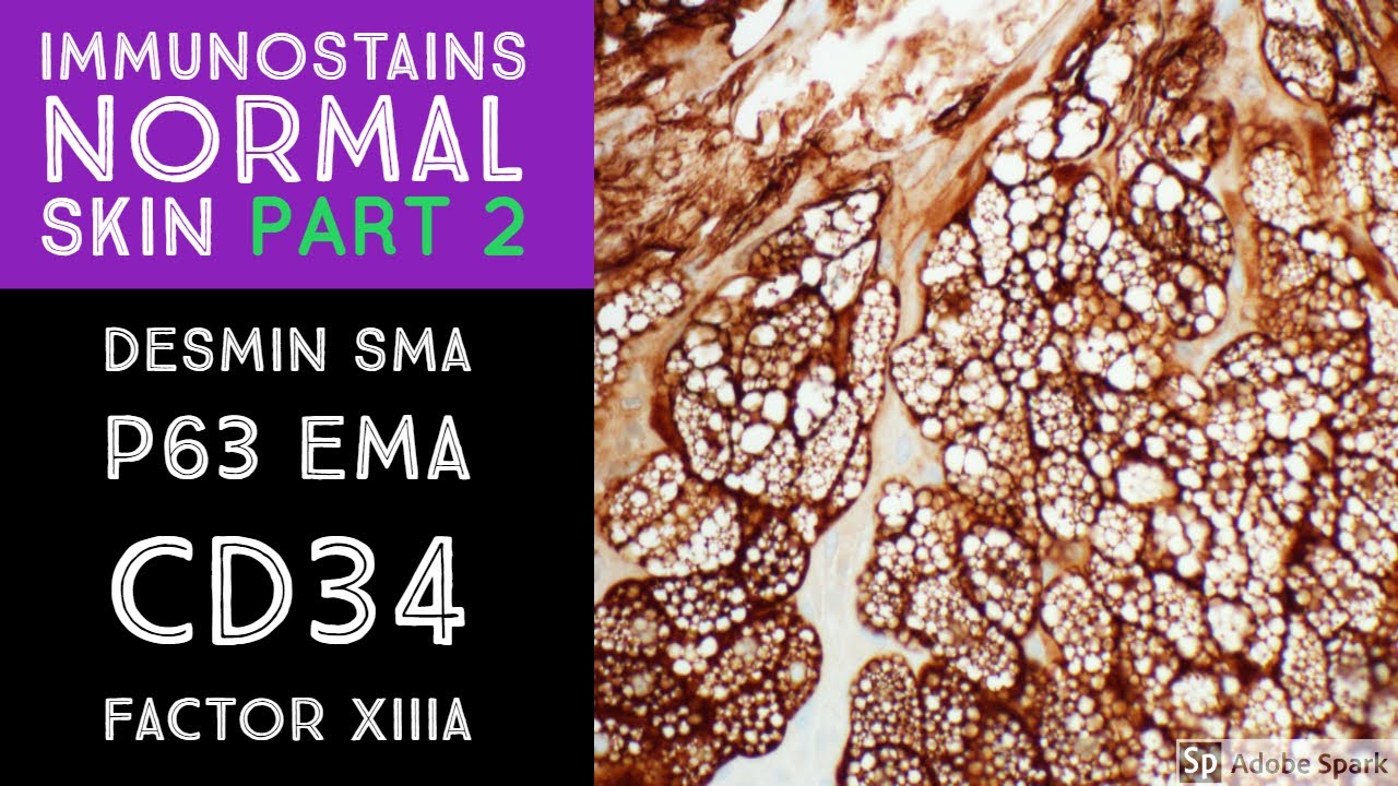 Immunohistochemistry in Normal Skin: p63, EMA, desmin, SMA, CD34, Factor XIIIa