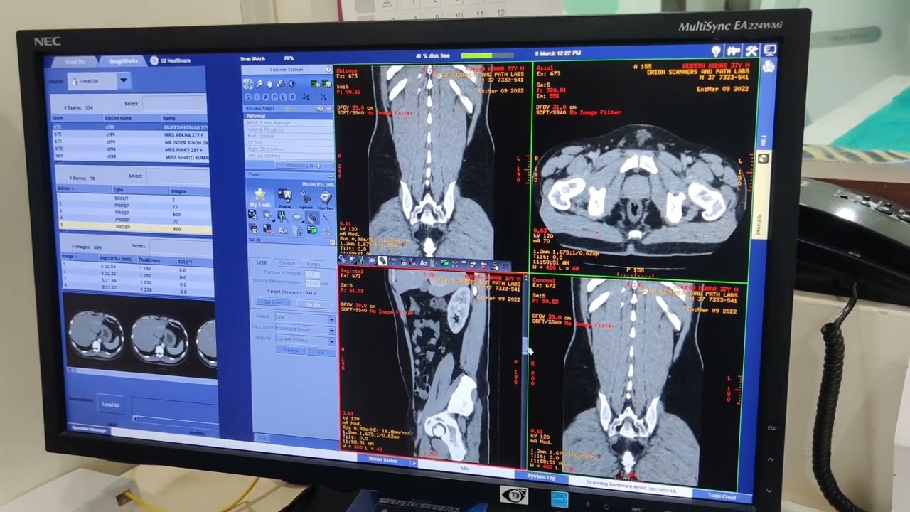 cect urography with filming radiology 2022 ge 32Slice