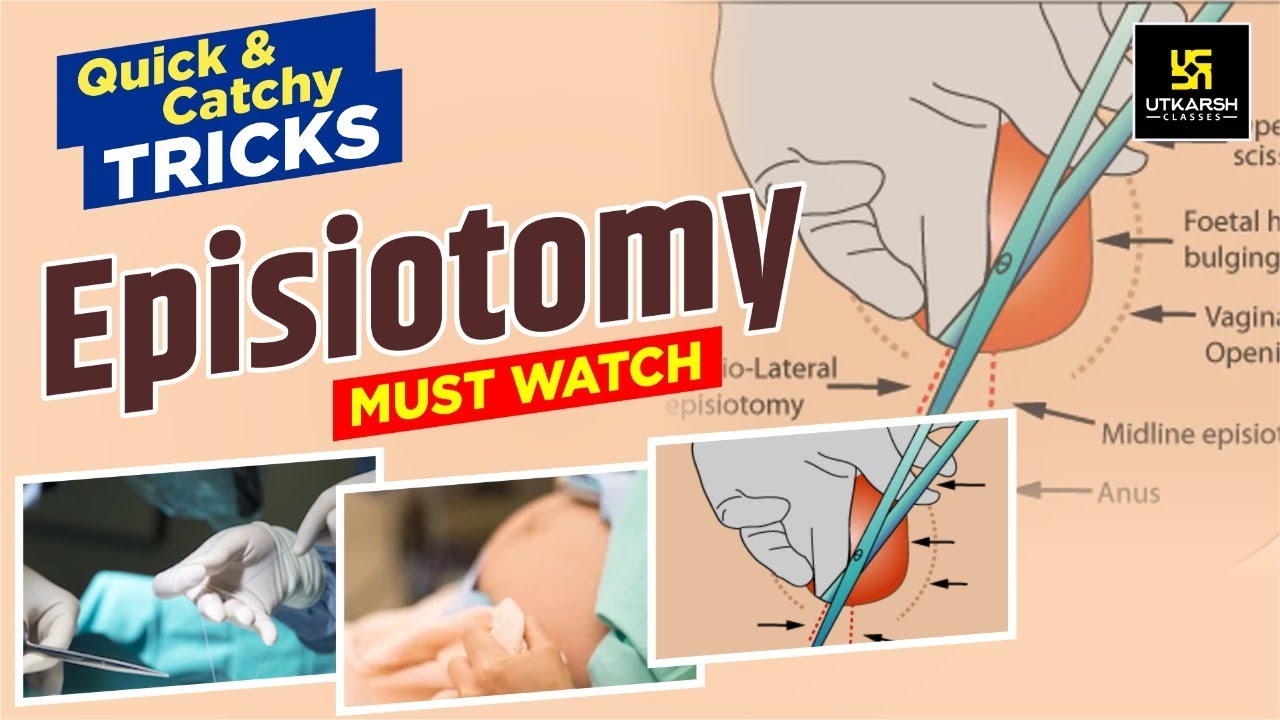 Episiotomy || Quick Trick || Easy Way To Learn Episiotomy  || By Utkarsh Nursing Classes