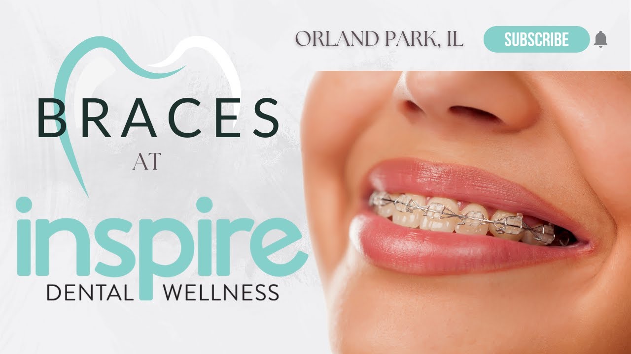 Orland Park Dentist | Braces at Inspire Dental Wellness