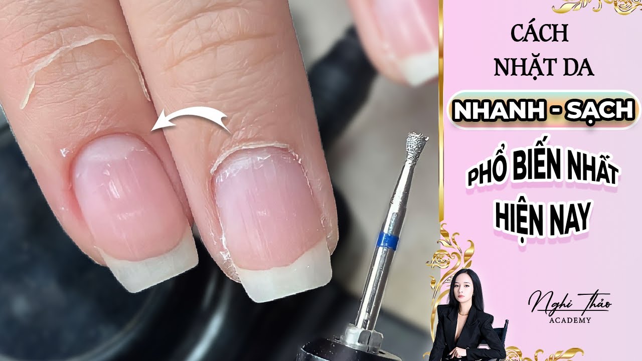 Cách nhặt da nhanh, sạch, phổ biến nhất hiện nay