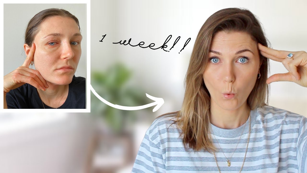 5 EASY tips to change your MINDSET and heal your skin FAST! How I cured my eczema flare up in 1 WEEK