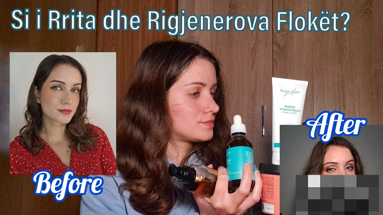 Si të rrisim Flokët? / Këshilla të vlefshme 🍀