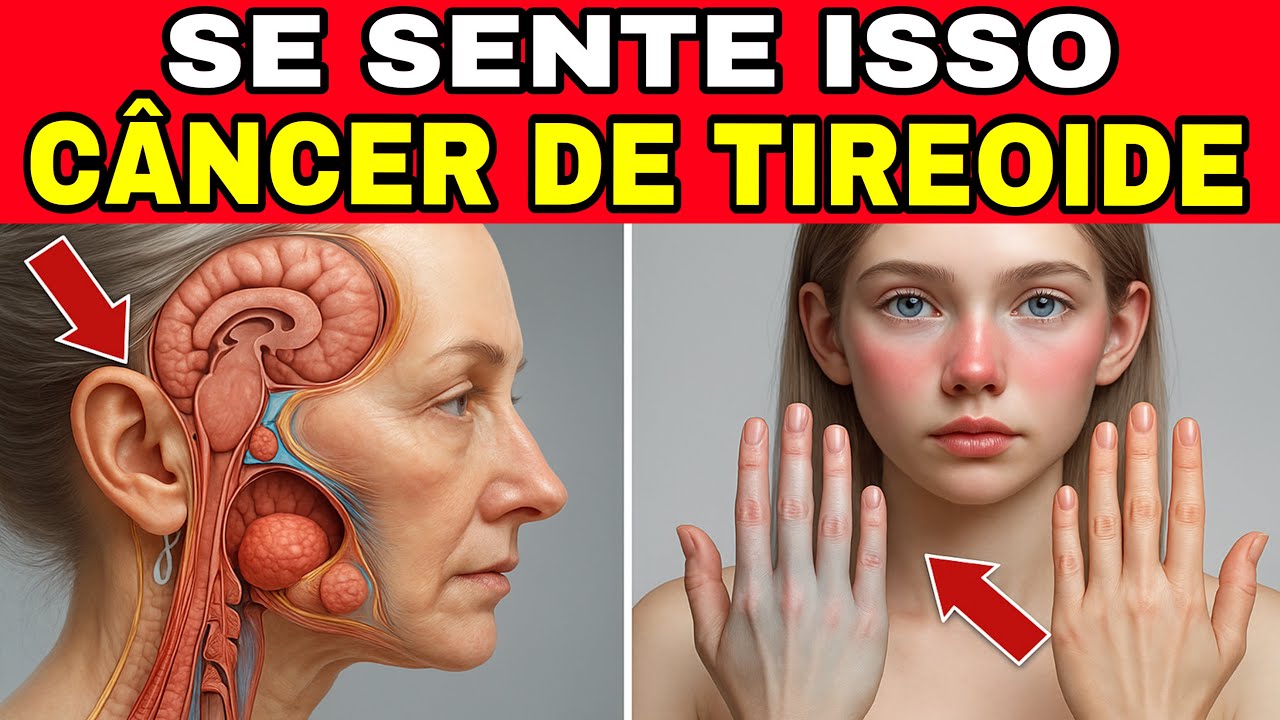 Se Você Sente ISSO Pode Ser CÂNCER de TIREOIDE! (7 Sinais de Alerta)