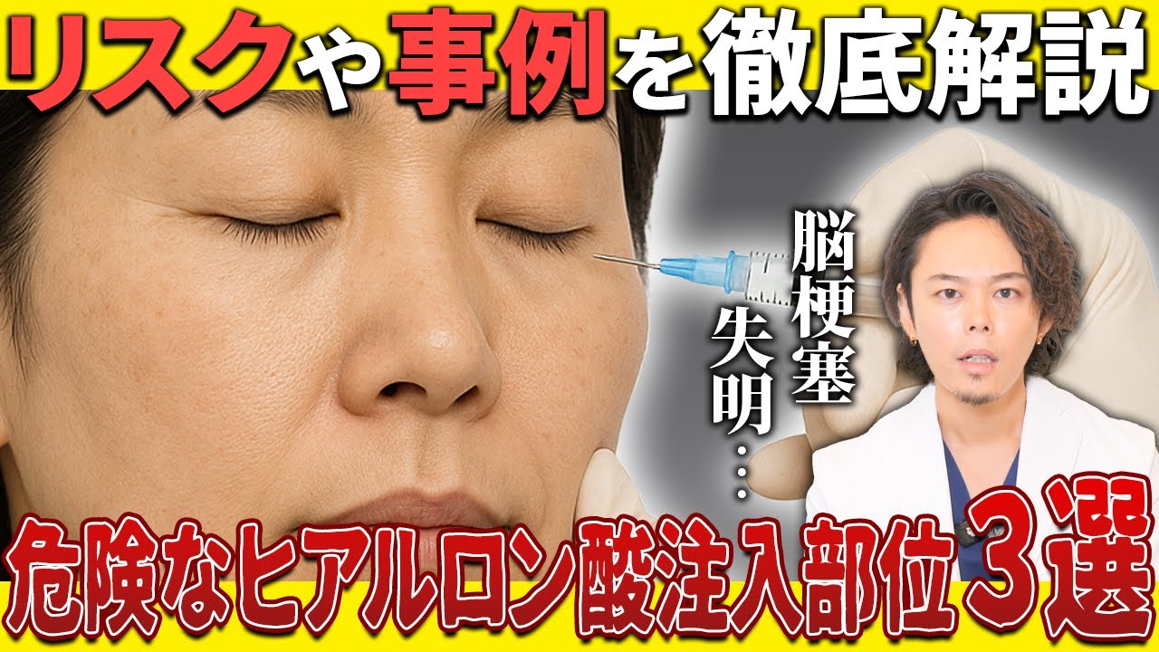 ヒアルロン酸注入のリスク部位3選と論文に基づく現状を医師が解説