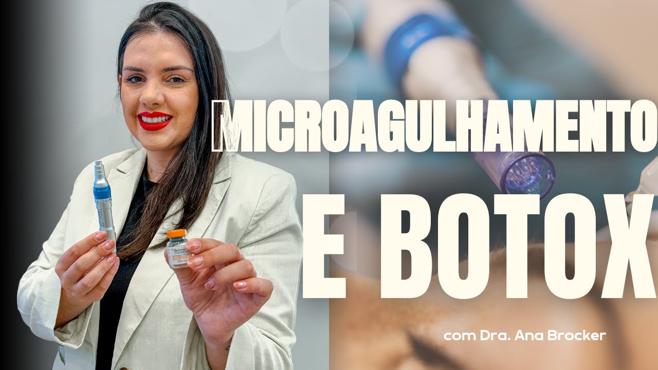 COMO FAZER MICROAGULHAMENTO COM BOTOX | Técnicas associadas
