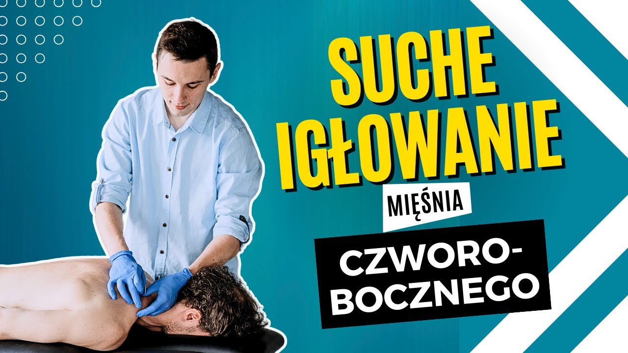 Suche igłowanie mięśnia czworobocznego w łagodzeniu b&oacute;lu głowy