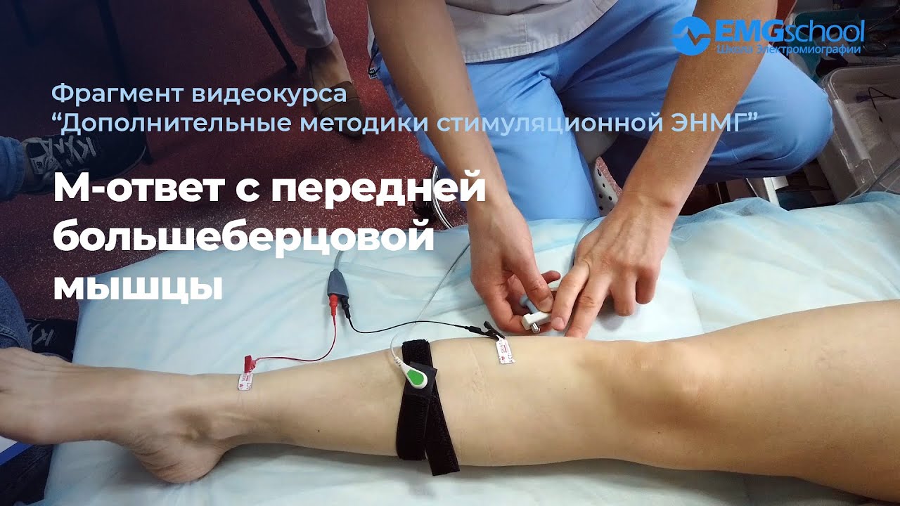 М-ответ с передней большеберцовой мышцы. Фрагмент видеокурса по ЭНМГ