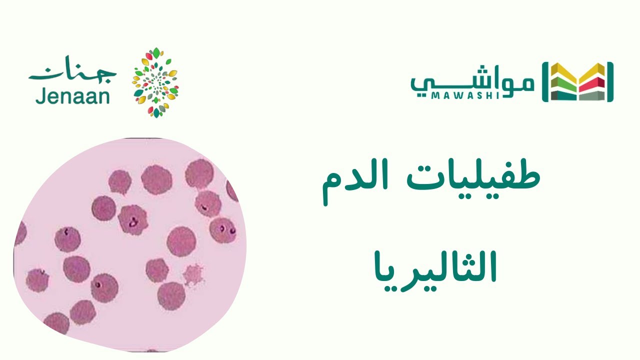 طفيليات الدم - الثاليريا