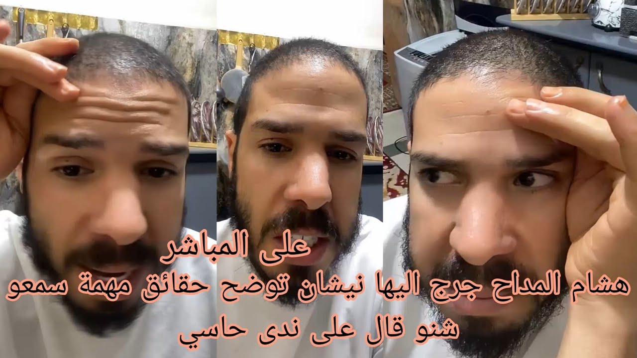 هشام المداح جرج اليها نيشان توضح حقائق مهمة سمعو شنو قال على ندى حاسي 